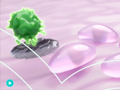 Type 1 Diabetes: Mechanism of Beta Cell Loss Caused by Autoimmune T Cells